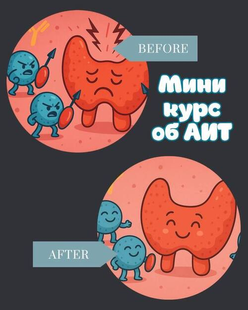 [Лариса Чумак] [endo_doc_] Мини курс по АИТ (2025)_0.png